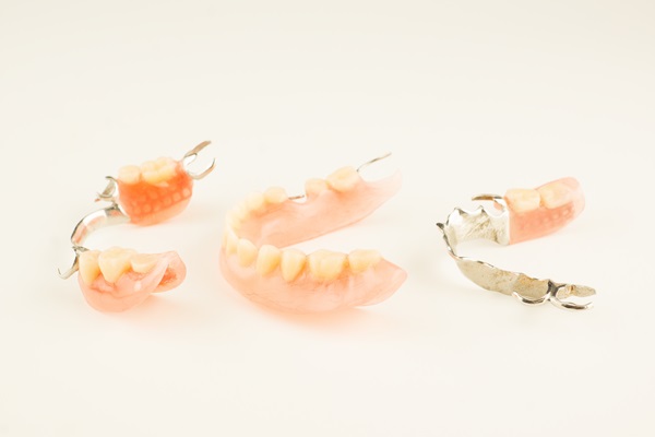 Repair Options for Partial Dentures