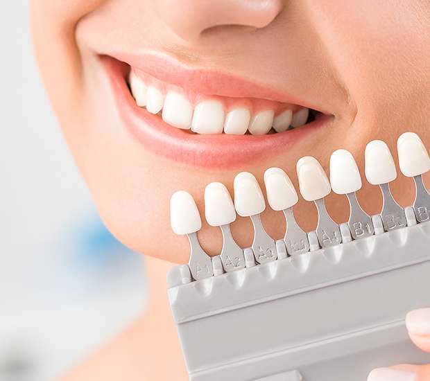 Hurst Dental Veneers and Dental Laminates