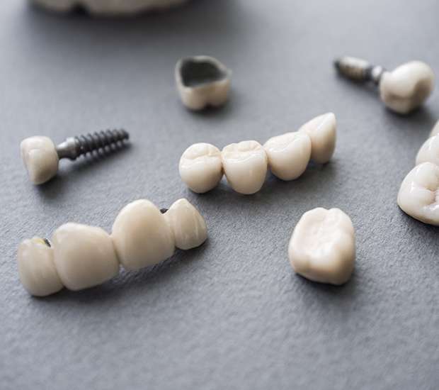 Hurst The Difference Between Dental Implants and Mini Dental Implants