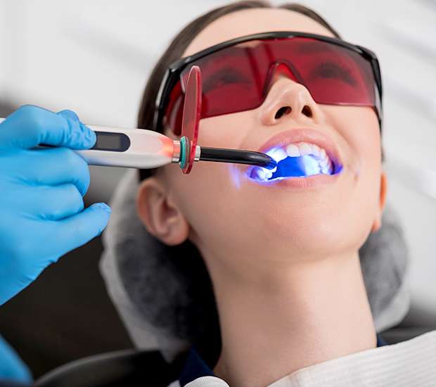 Hurst Professional Teeth Whitening